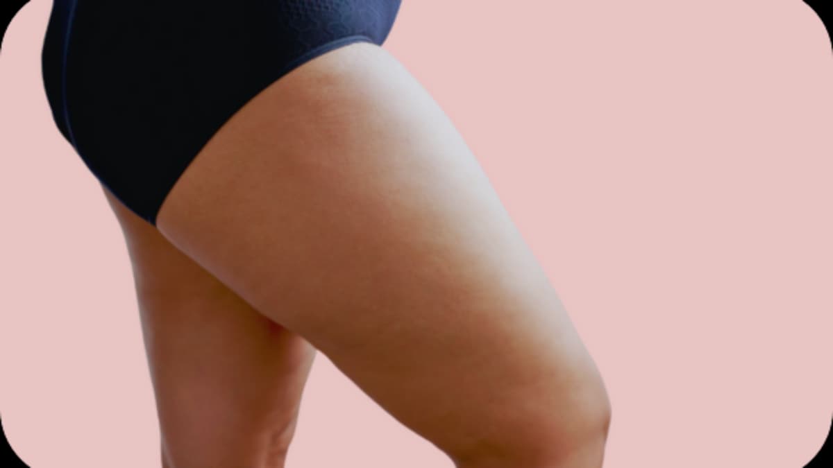 Lipödem Behandlung und Sport: Welche Bewegungen helfen wirklich?
