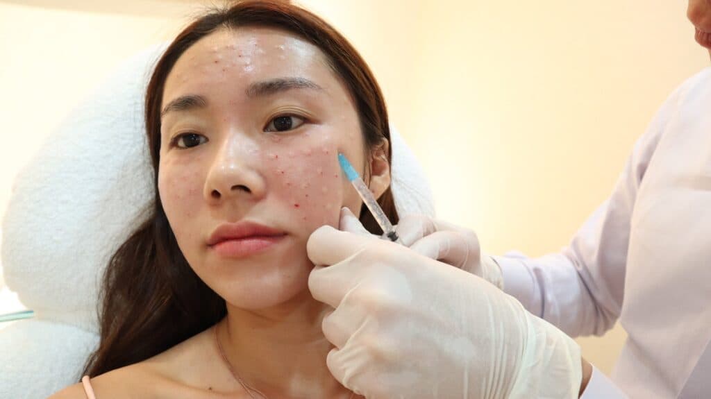 Augenpflege auf höchstem Niveau mit plinest eye bei MorySkin