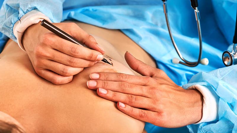 Bruststraffung und ihre Rolle in der Ästhetischen Chirurgie