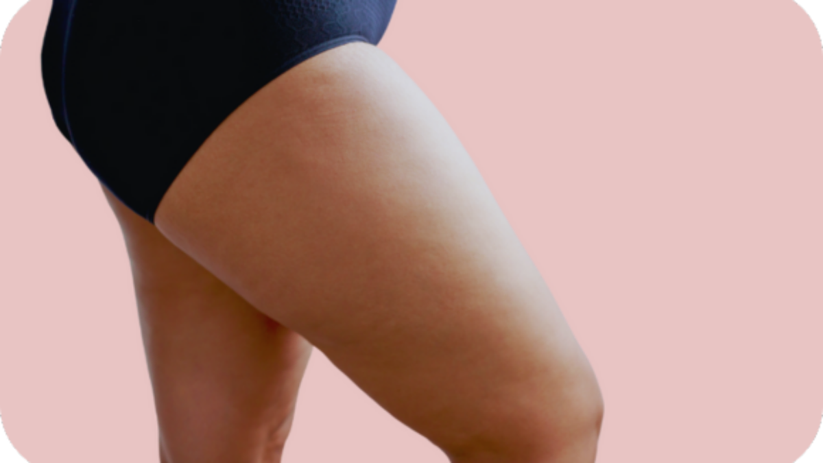 Lipödem Behandlung und Sport: Welche Bewegungen helfen wirklich?